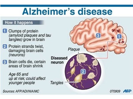 the study of alzheimers disease and The study, published in the journal alzheimer's & dementia, looked at more than 900 people between the ages of 58 and 98 who filled out food questionnaires and underwent repeated neurological testing. the study of alzheimers disease and The study, published in the journal alzheimer's & dementia, looked at more than 900 people between the ages of 58 and 98 who filled out food questionnaires and underwent repeated neurological testing.